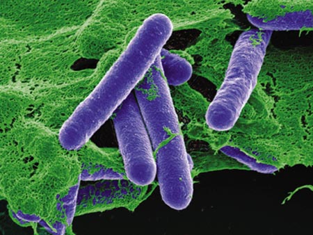 Botulismo Clostridium Botulinum Bacteria C: Corbis/Stock Photos