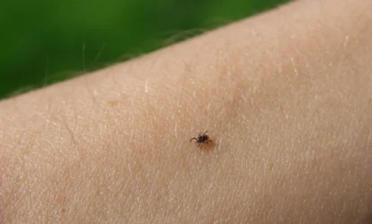 Kleszcze na ciele człowieka – jak rozpoznać ugryzienie przez kleszcza – klaudynahebda.pl